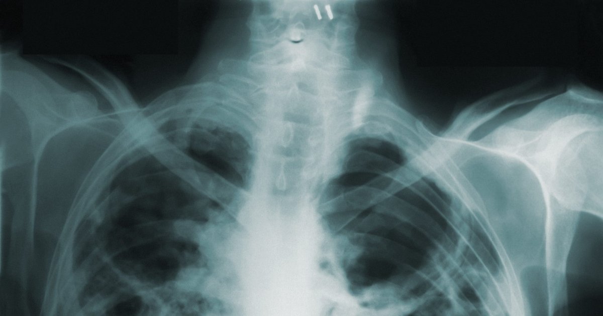 NHS invests £21 million in AI for diagnosis and treatment | AI Magazine