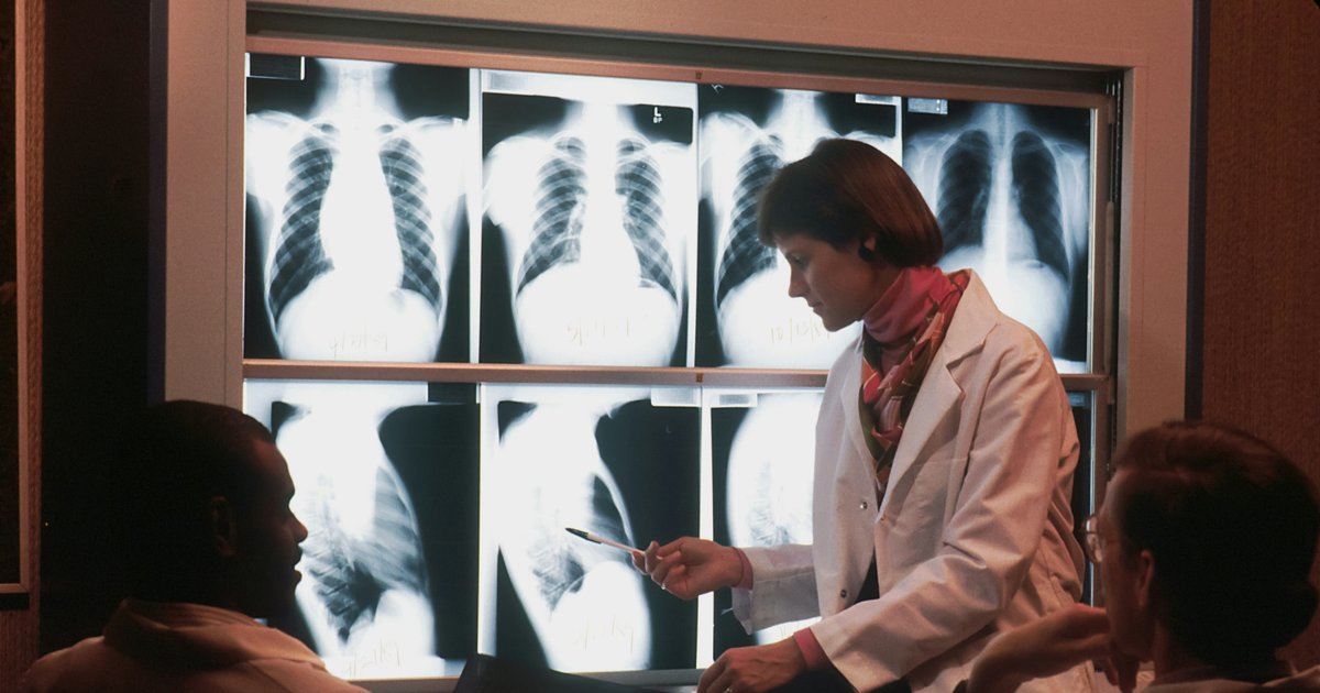 Telefónica Tech and Harrison.ai Collaborate on AI X-Ray Technology