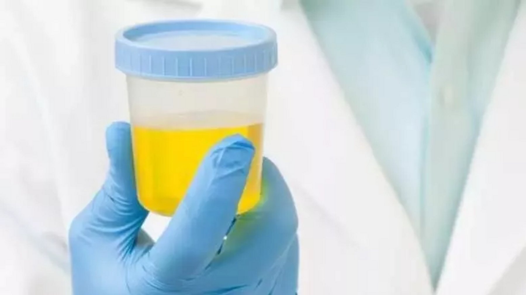 Why random drug testing in the workplace is a good idea Healthcare