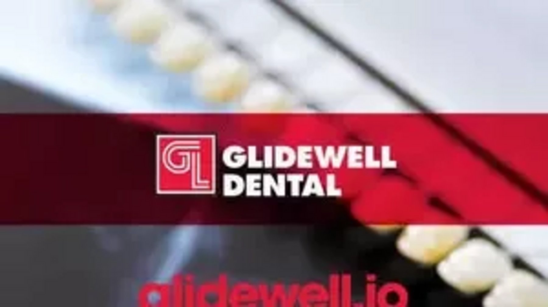 Glidewell Dental: launching an in office chairside milling solution for