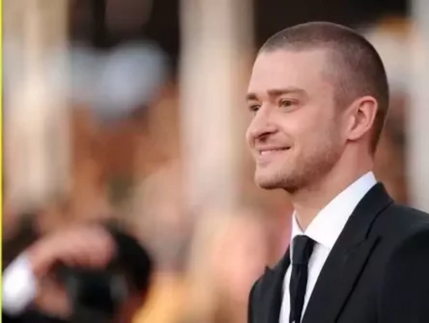 Justin Timberlake Trichotillomanie