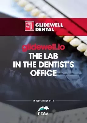 Glidewell Dental: launching an in-office chairside milling solution for dentists powered by digital