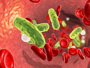 Top 10 facts about sepsis: technology & hospitalisation