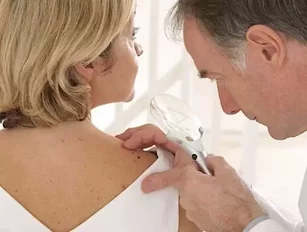 5 ways the medical community is spreading skin cancer awareness