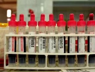 Blood test shows patients' response to cancer treatment