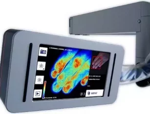 Camera shows blood flow in skin to help burns victims