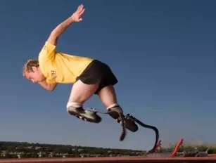 Oscar Pistorius and &Ouml;ssur: Prosthetic technology of Olympic proportions