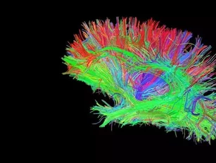 World's first 3D hologram of the brain unveiled in Edinburgh