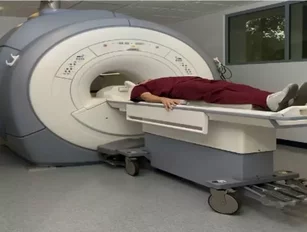 Findings say sophisticated brain scans can be used to perfectly predict age