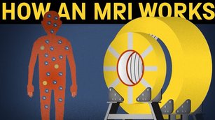 How does an MRI machine work?