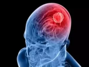 Parents need to be vigilant in spotting brain tumours