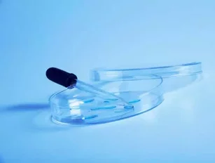 NICE backs Europe's first stem cell therapy for NHS use