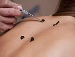 6 Medieval Medical Practices You Won't Believe Doctors Are Still Using Today