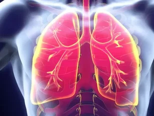 China uses AI to treat lung cancer