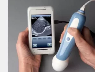 Ultrasound device for smartphones launched