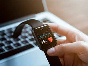 Wearables market to see 344.9mn shipments in 2022