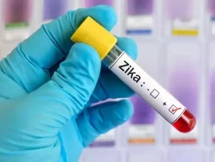 Laval University to hold world’s first Zika vaccine test on humans