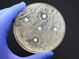 Antibiotic resistance has reached such a pitch that it now poses a major global threat to people, public health, society and economies worldwide.