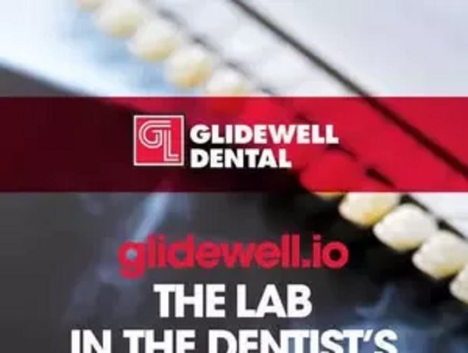 Glidewell Dental launching an inoffice chairside milling solution for