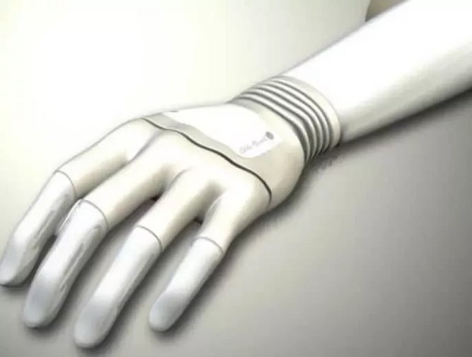 Ground breaking bionic hand fitted in the UK | Healthcare Digital